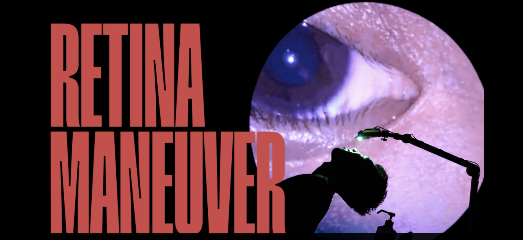 Video »Retina Maneuver«